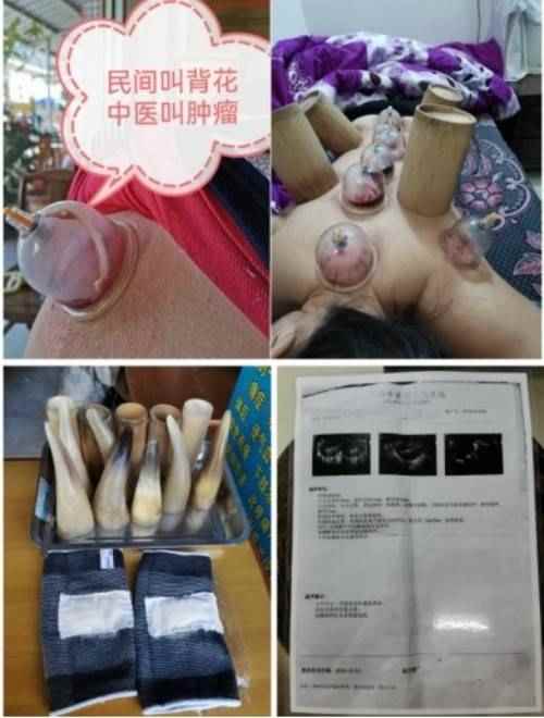 凝聚中国力量 争当时代楷模 蓝信全的中医传承实践与创新研究
